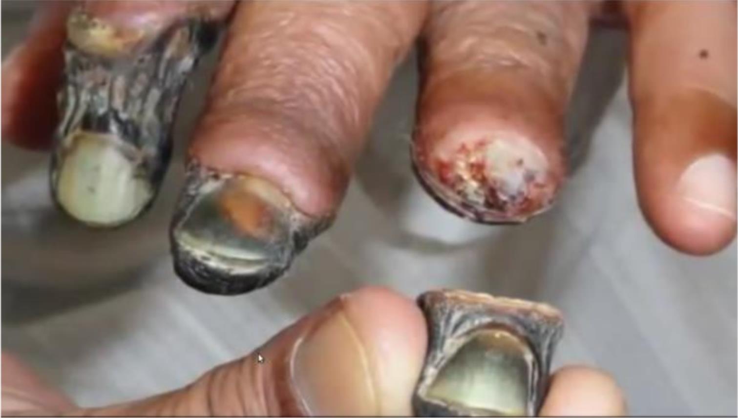 Droga krokodil