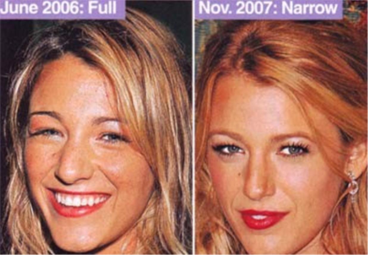 Blake Lively