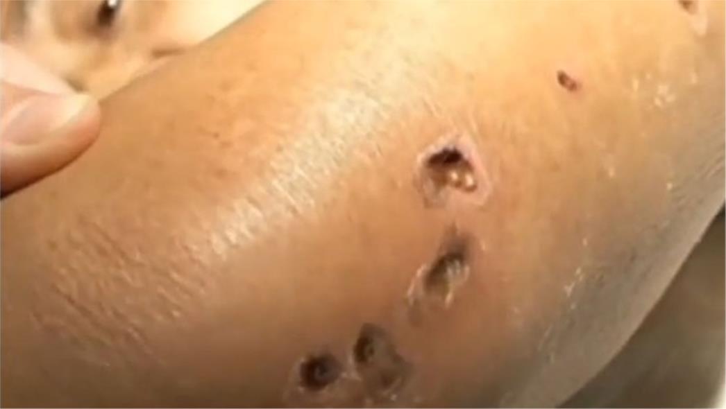 Pitanje je dana kada će stršljeni ubojice stići u Hrvatsku!