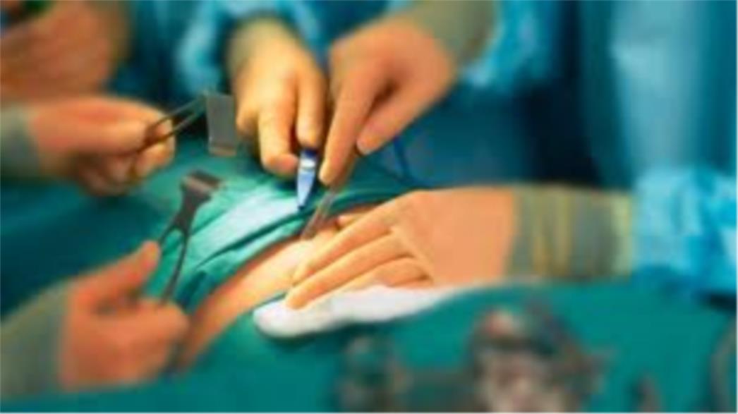 I OVO SE DOGAĐA: Britanski kirurg napisao svoje inicijale na jetri pacijenta