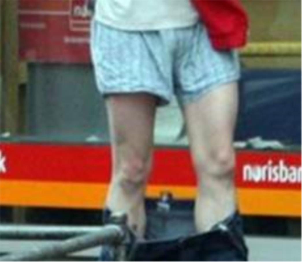 Lopov tuži policiju, jer su ga priveli spuštenih hlača