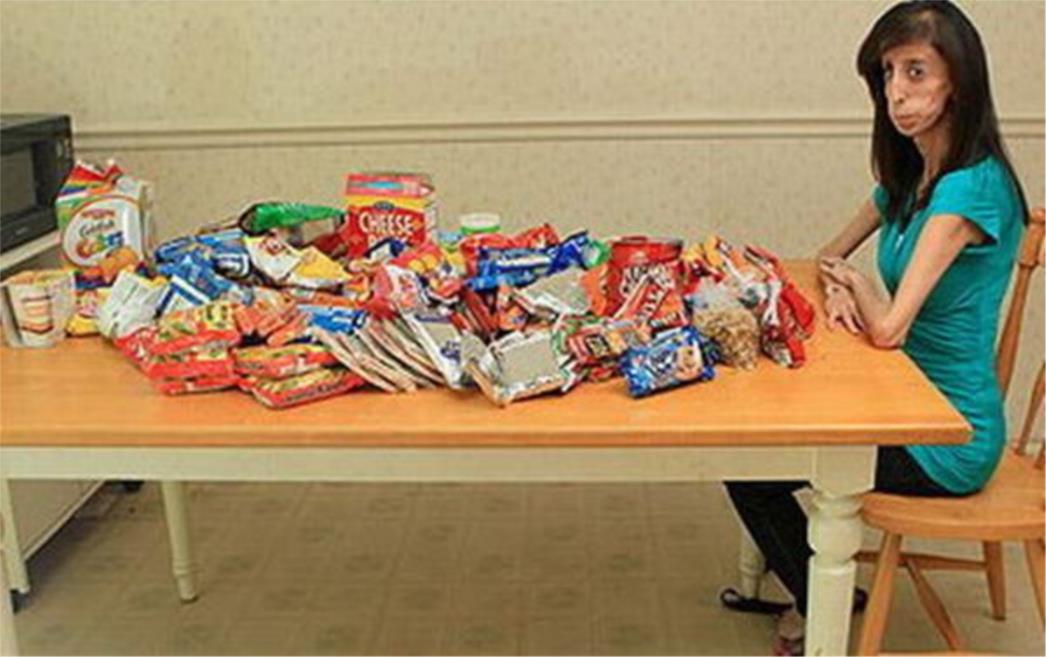  Jede cijeli dan, a ima samo 27 kilograma