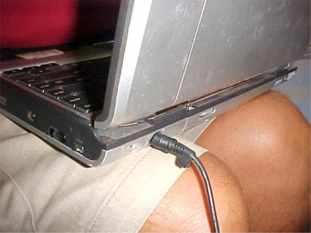 Držanje laptopa u krilu dovodi do - diskoloracije kože!