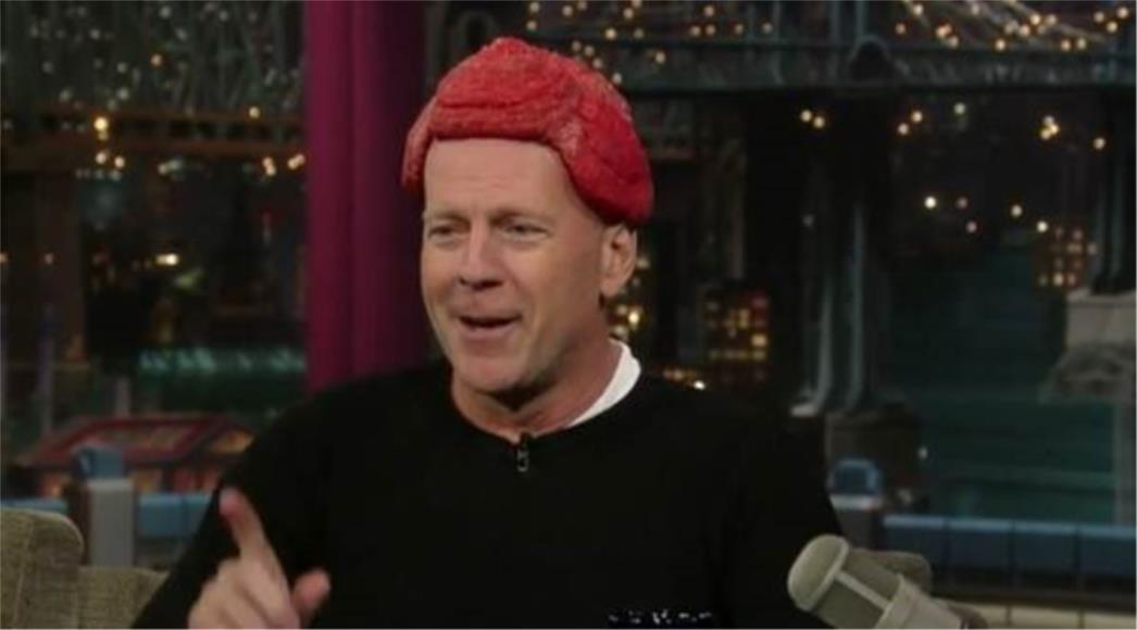  Bruce Willis po uzoru na Lady Gagu nastupio s odreskom na glavi