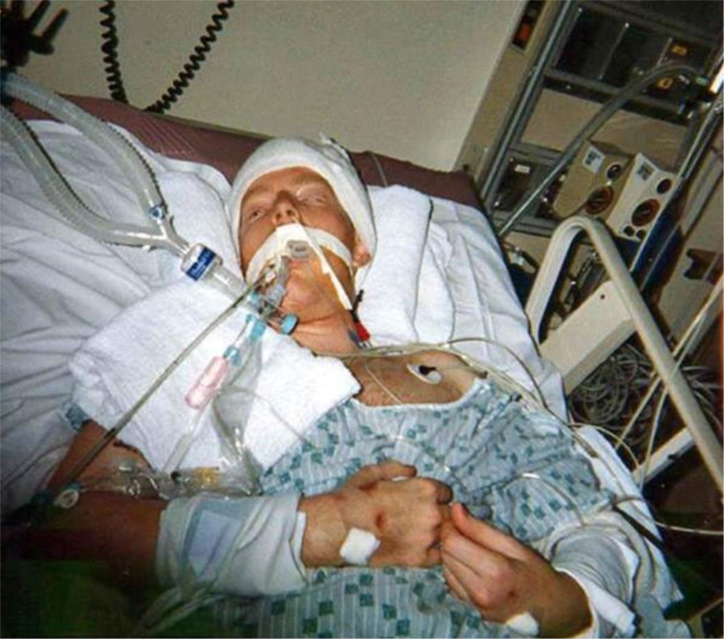 Ruski novinar u komi nakon brutalnog napada