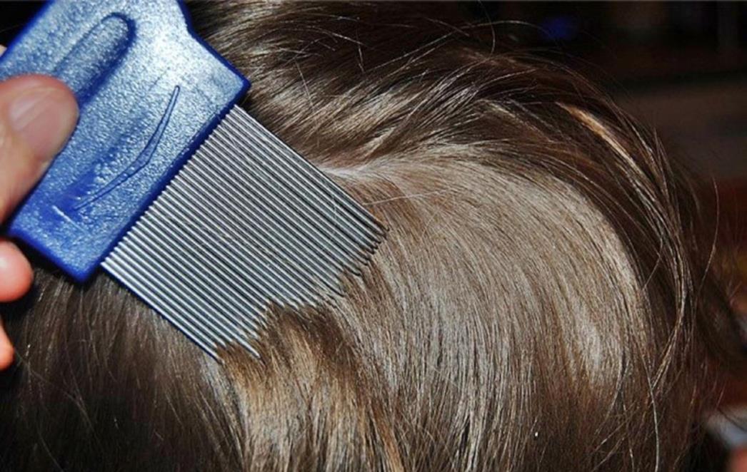 OTPORNI BAŠ NA SVE: Roditelji u panici, pojavili se mutirani nametnici  koje je nemoguće istrijebiti!