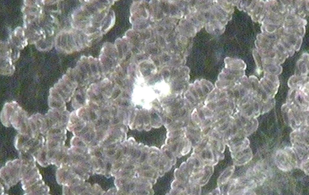 DARKFIELD ANALIZA Ulazak u živi svijet vlastitih krvnih stanica