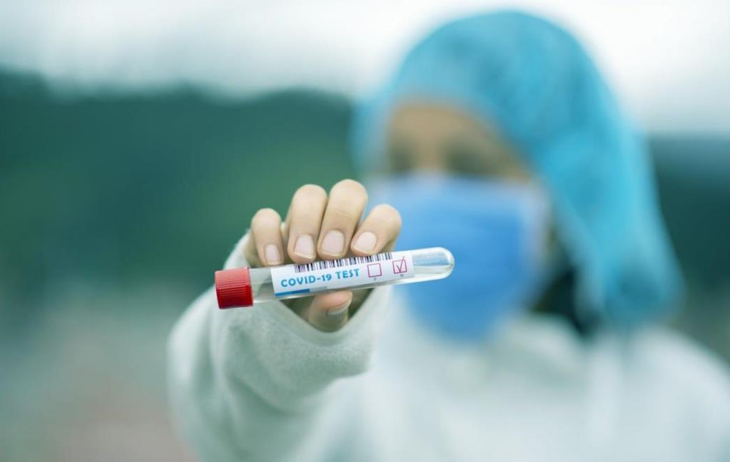 NEMA NOVOZARAŽENIH KORONAVIRUSOM U ŽUPANIJI Jedna osoba hospitalizirana, nitko nije u samoizolaciji