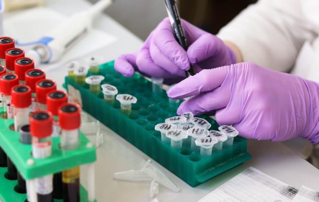 Brzi serološki testovi došli u Hrvatsku, evo tko će se prvo testirati