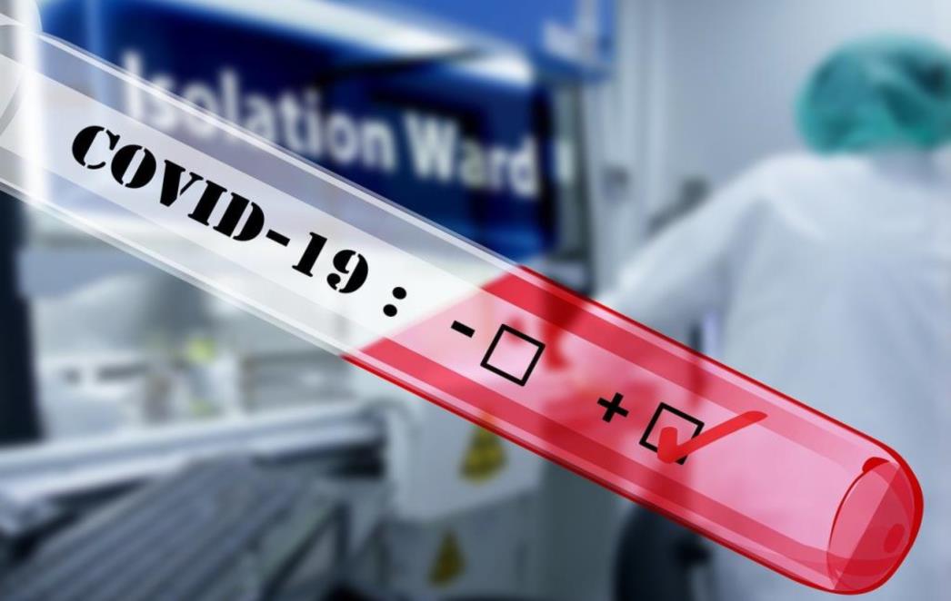 KORONAVIRUS PONOVO NAPADA Troje novozaraženih, svi su zdravstveni djelatnici