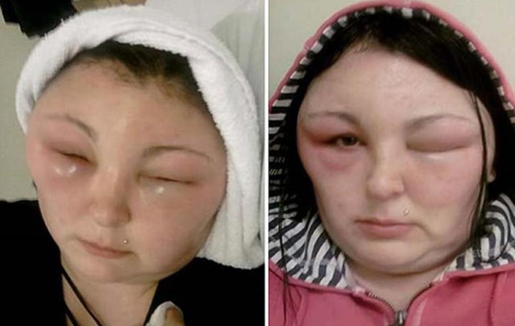 OPREZA NIKAD DOSTA! Bila u životnoj  opasnosti  radeći stvar koju mnogi vjerojatno često rade kod kuće!