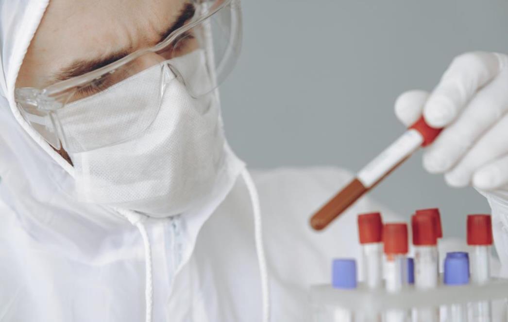 'Samo je jedan način kako svijet može pobijediti pandemiju'