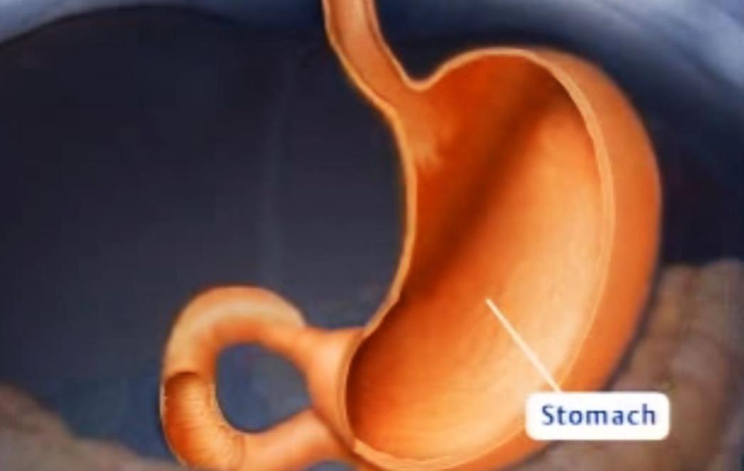 Gastritis u proljeće: Zašto je češći i   kako si   pomoći