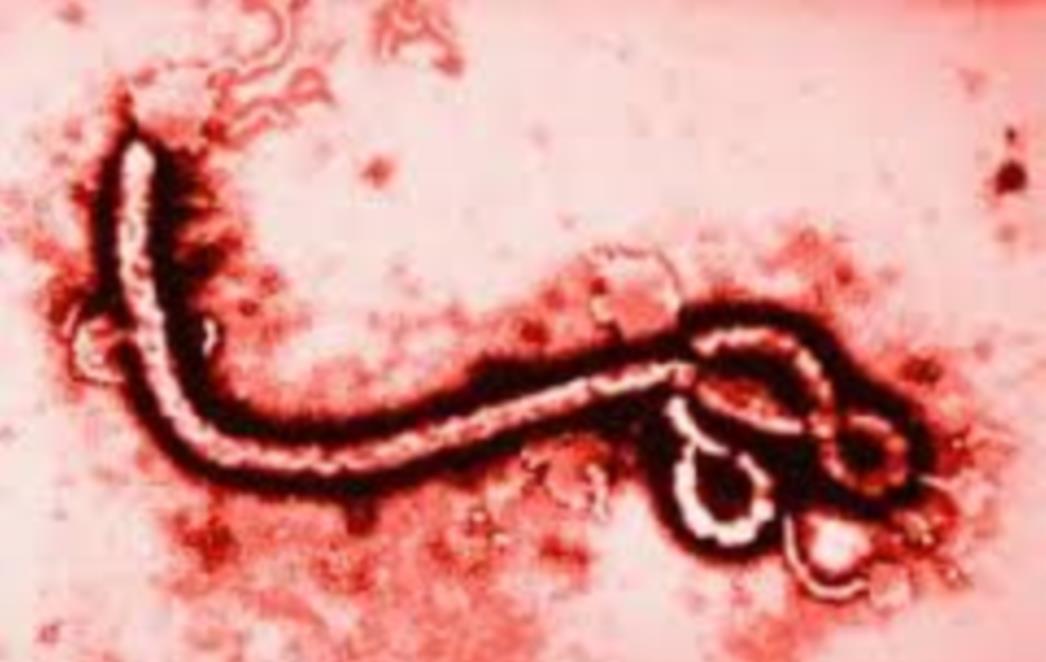 EBOLA PROGLAŠENA MEĐUNARNOM PRIJETNOM: U Hrvatskoj pojačan nadzor, ovo trebate znati o virusu