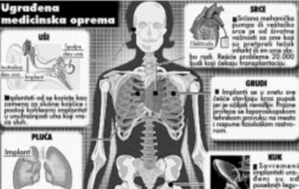 Implantati koji mogu produžiti život