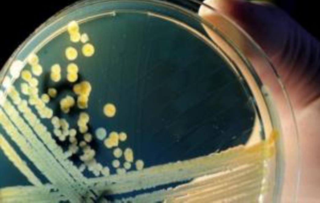 Svaki peti čovjek bio zaražen virusom H1N1