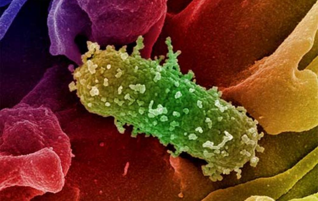 E.coli prešla ocean: Četvero zaraženih u SAD-u