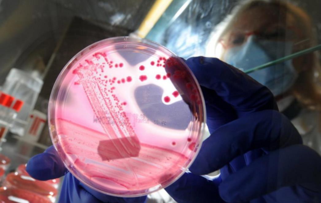 Njemačka proglasila kraj epidemije E.Coli