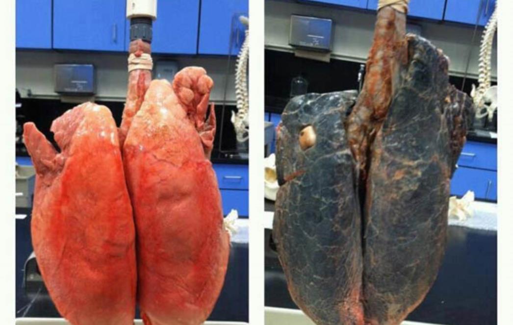 PREVARENI SMO? CRNA PUŠAČKA PLUĆA NE POSTOJE: Mnogi stogodišnjaci pušili su i 60 cigareta dnevno!