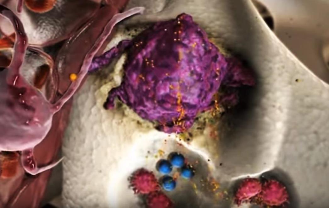 Loši rezultati onkološke terapije: Veliki problem uzimanje raznovrsne terapije  na svoju ruku