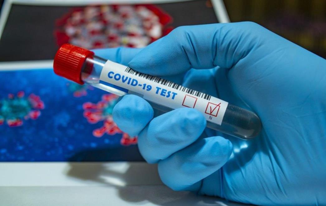 Znanstvenici su identificirali 5 simptoma koji mogu predvidjeti dugoročne slučajeve koronavirusa