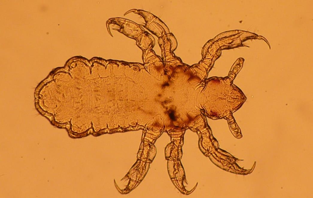 EPIDEMIJA PRED KOJOM SE ZATVARAJU OČI: ‘Za vikend mu očistim kosu, već prvi dan se iz škole vrati s mutantima’