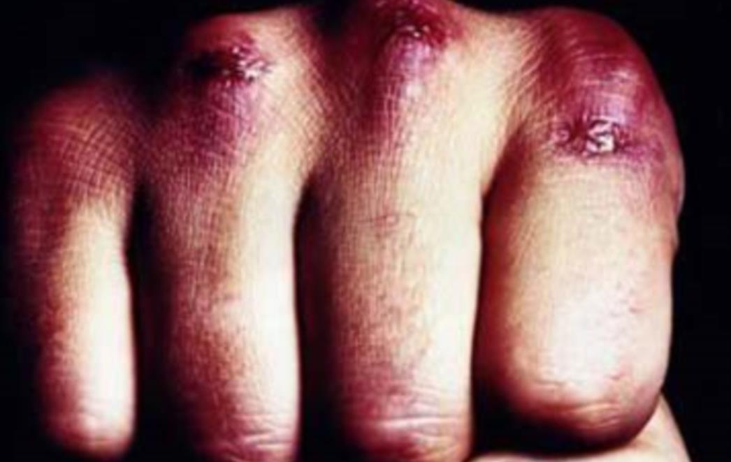 Tri nasilnika brutalno pretukla 22-godišnjaka