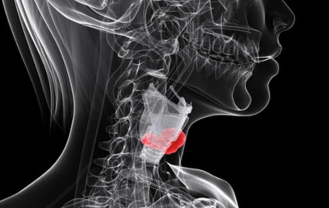 Snažna povezanost oboljenja štitnjače i nepodnošenja  glutena  šokirala istraživače