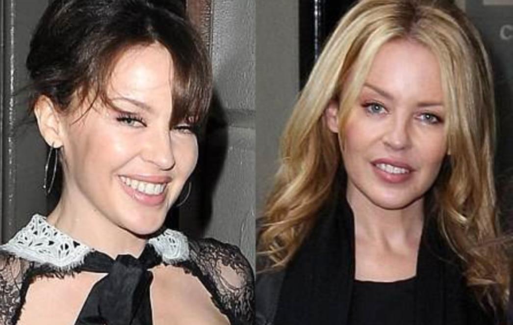 Što se dogodilo Kylie Minogue? (FOTO)
