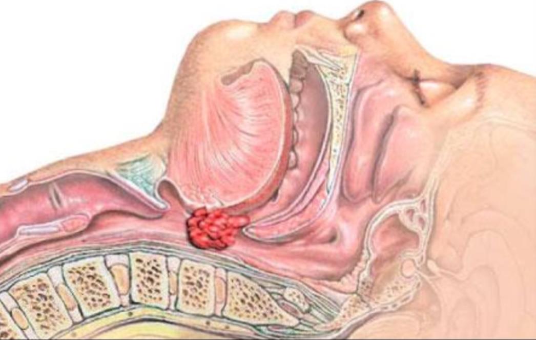 Prepoznajte pritajene simptome apneje!