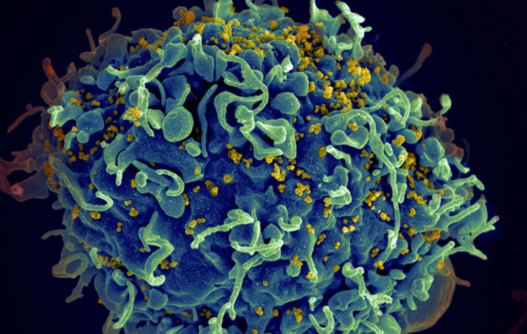 PANIKA: Novi soj HIV-a širi se velikom brzinom i odgovoran je za 50 posto novih zaraza!