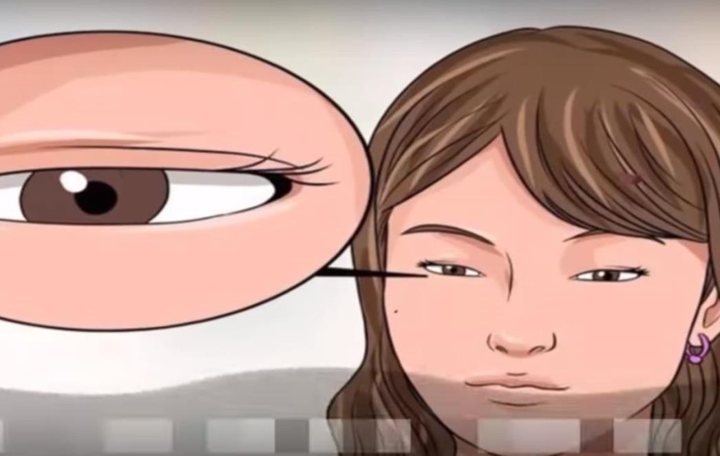 TITRA VAM KAPAK Evo kada je to opasno (VIDEO)