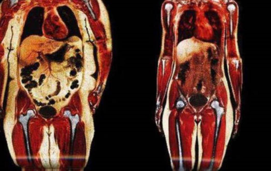 Hrvatskoj prijeti povećanje broja oboljelih od ovih bolesti