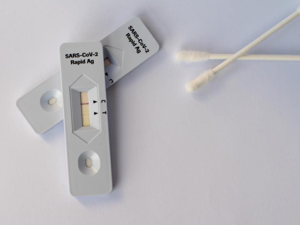 Imamo 16.017 novozaraženih kad se zbroje PCR i antigenski testovi