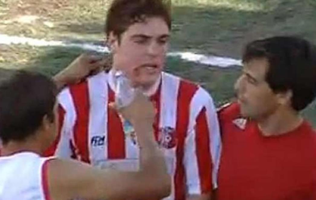 Golman ugrizao napadača za lice