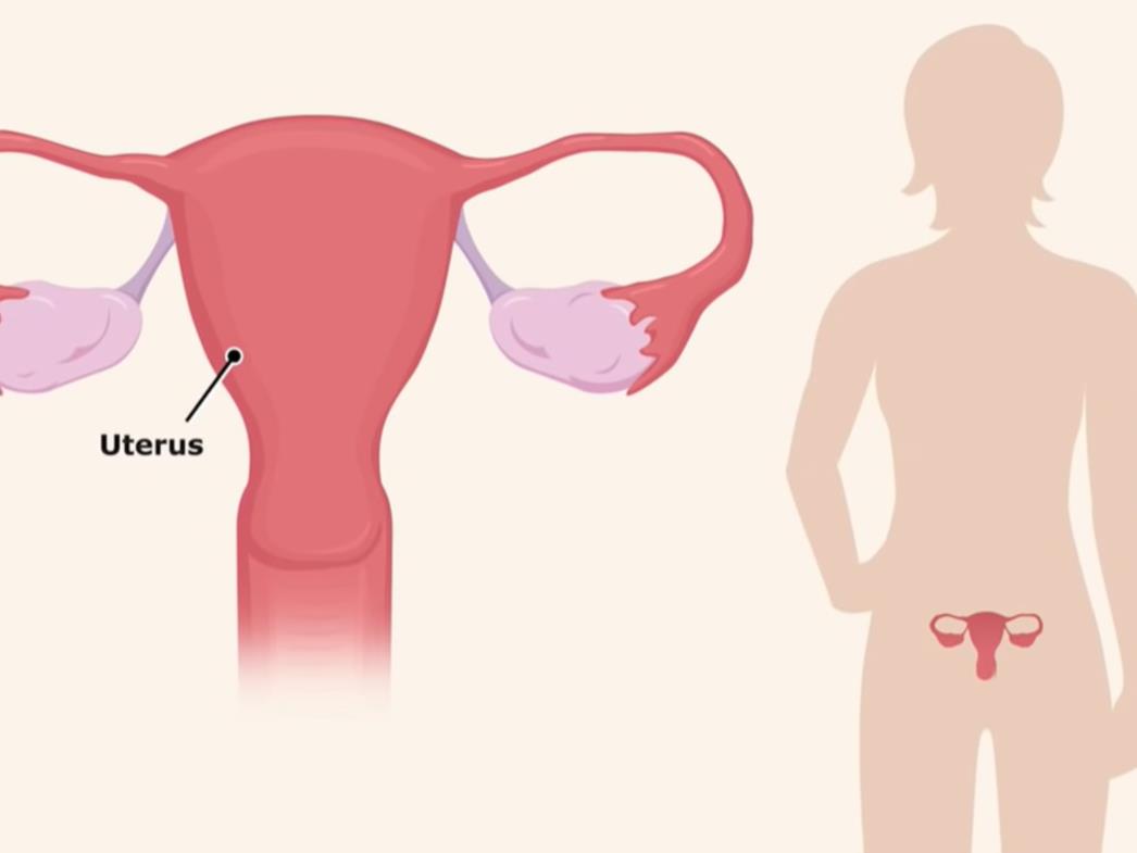 Što je menstrualna gripa i koji su simptomi
