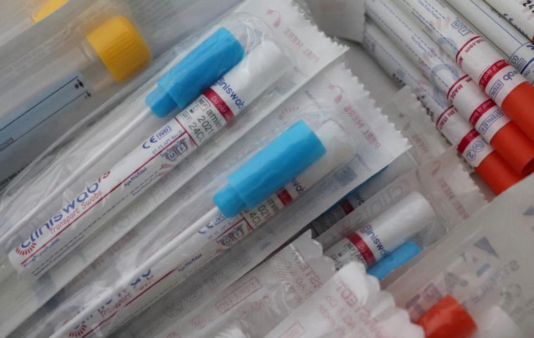 Koliko će trebati POTVRĐENOM cjepivu da stigne do "običnih smrtnika"