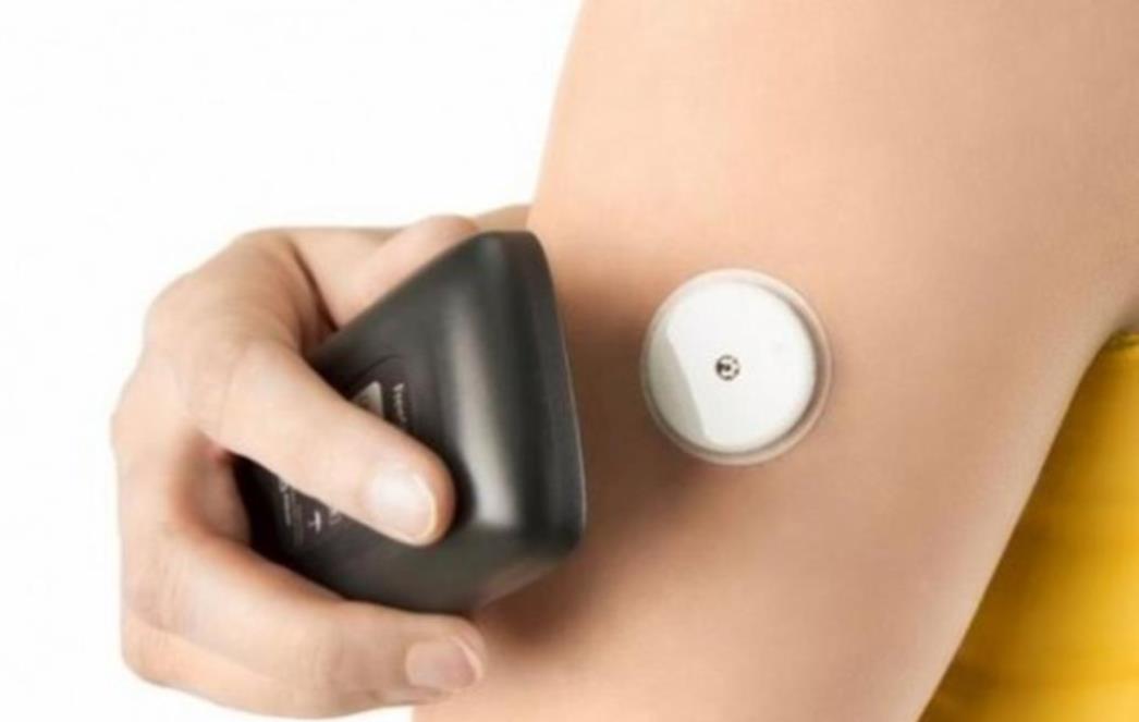 SPAS ZA  DIJABETIČARE Senzori za mjerenje šećera u krvi uskoro na teret HZZO-a