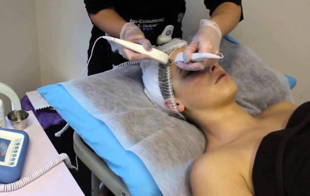 BEAUTY LINE: Nekirurški lifting  lica
