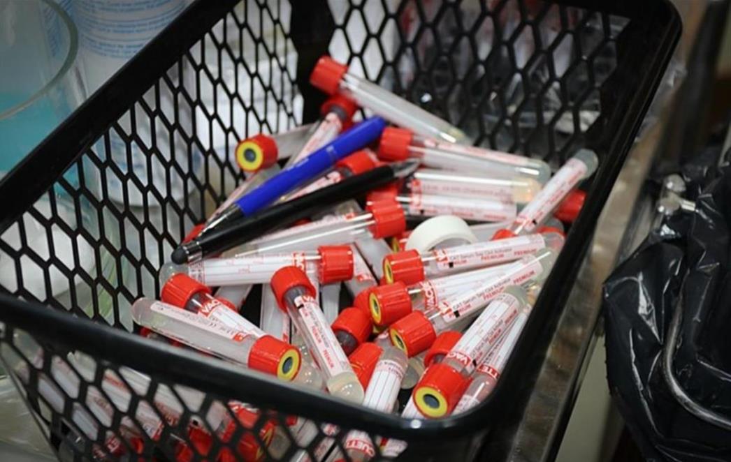 Nove cijene testova na COVID-19: Želite se testirati, a nemate uputnicu? Evo koliko ćete to platiti