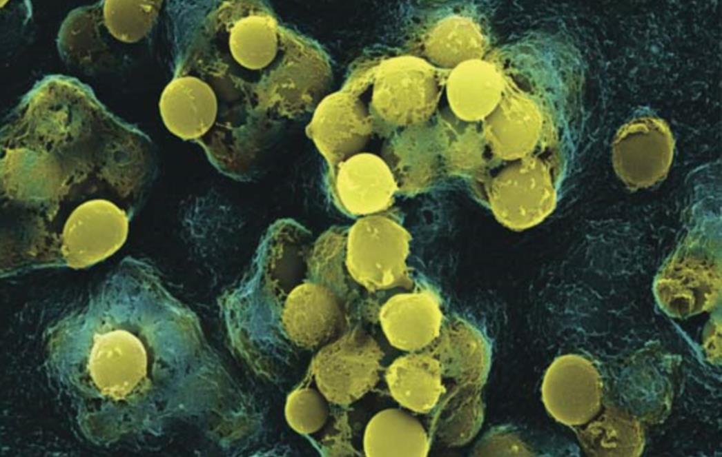 Šokirat ćete se kad saznate koliko bakterija živi u nama