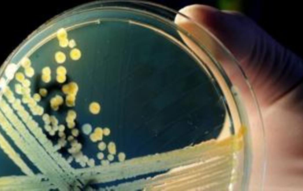Pojavio se supervirus koji u pet godina može ubiti sve ljude na Zemlji
