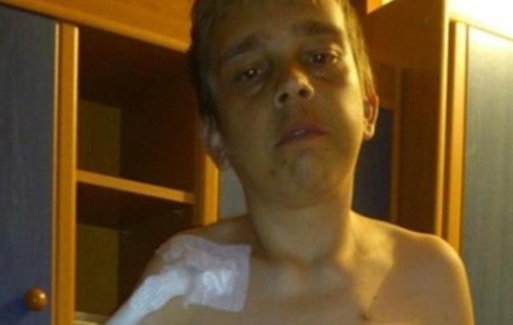 Dramatičan apel mladog Splićanina kojem su otkazala oba bubrega