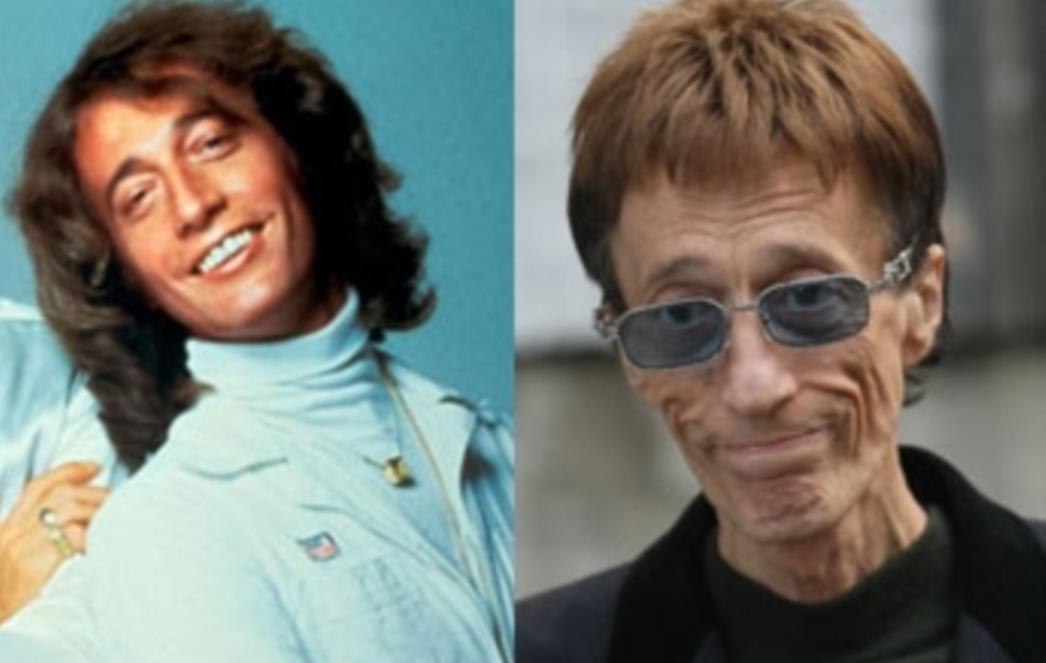 Preminuo Robin Gibb, pjevač grupe Bee Gees