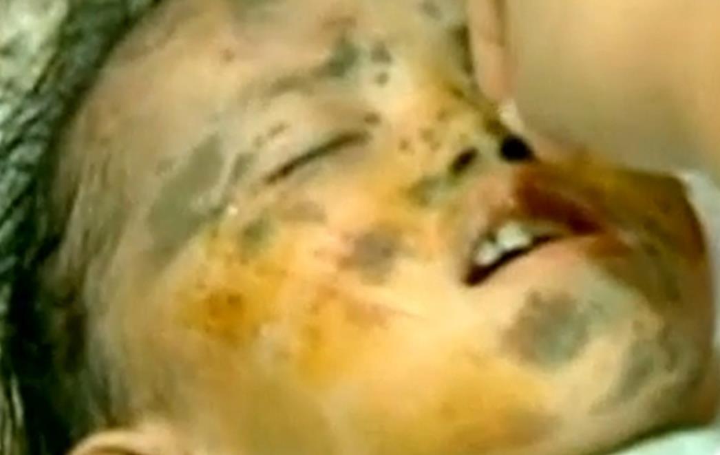 ČUDO NA FILIPINIMA Spasioci izvukli dječaka koji je u mulju preživio zakopan 24 sata!