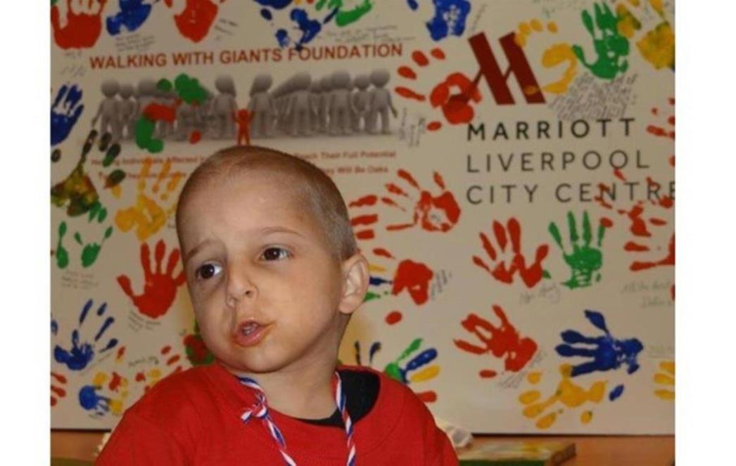 PRIČA DUBROVKINJE Moj Nevio jedini u Hrvatskoj ima sindrom zbog kojeg  sa 6  godina izgleda kao jednogodišnja beba