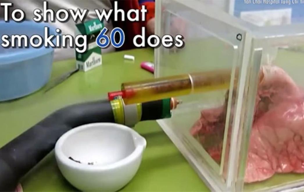 Ovaj jezivi video pokazuje kako pluća izgledaju nakon samo    60 cigareta (VIDEO)