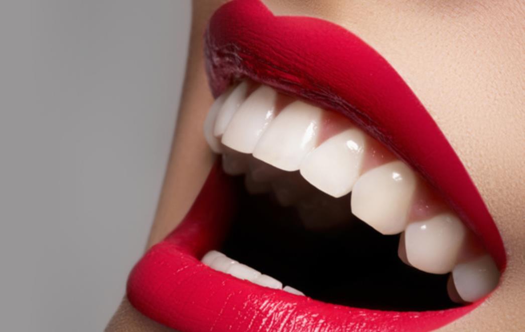 Hrana koju volimo, a koja nam uništava zube