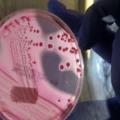 Zaraženi E. coli ne smiju uzimati antibiotike